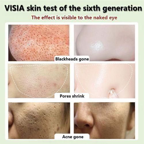 Masque Nettoyant Facial - Vert - miniature 5